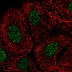DOK7 Antibody, Novus Biologicals 25 &mu;L, Unlabeled:Antibodies, Polyclonal